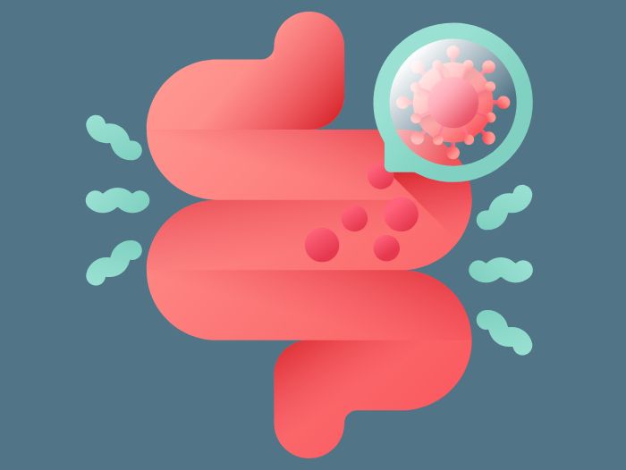 Leaky-Gut-Syndrom1 Ivonne-adams-de-leaky-gut-syndrom